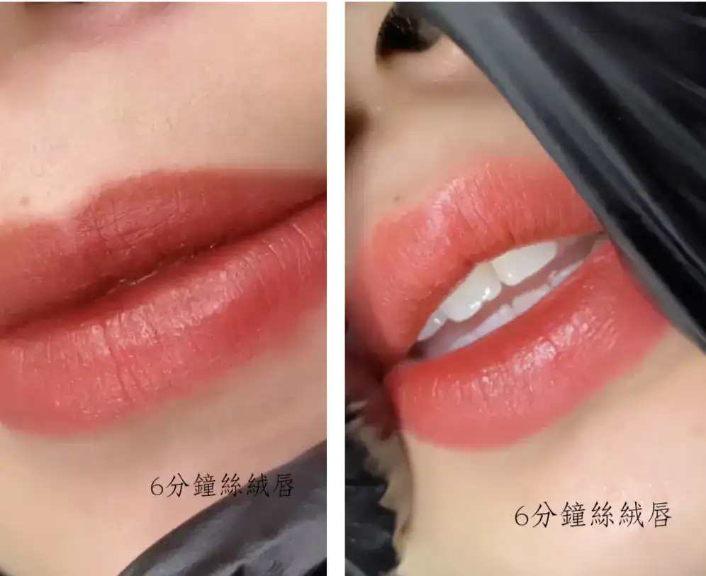 霧唇