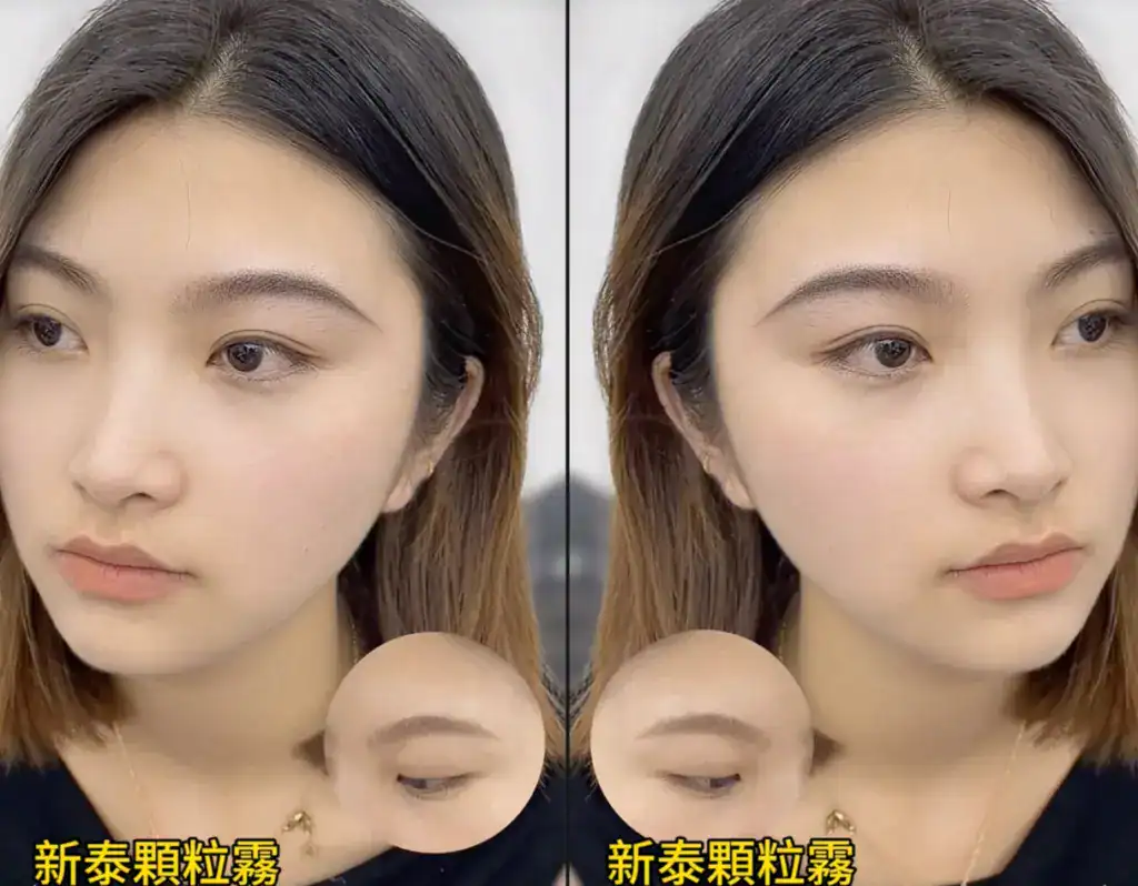 新泰顆粒霧